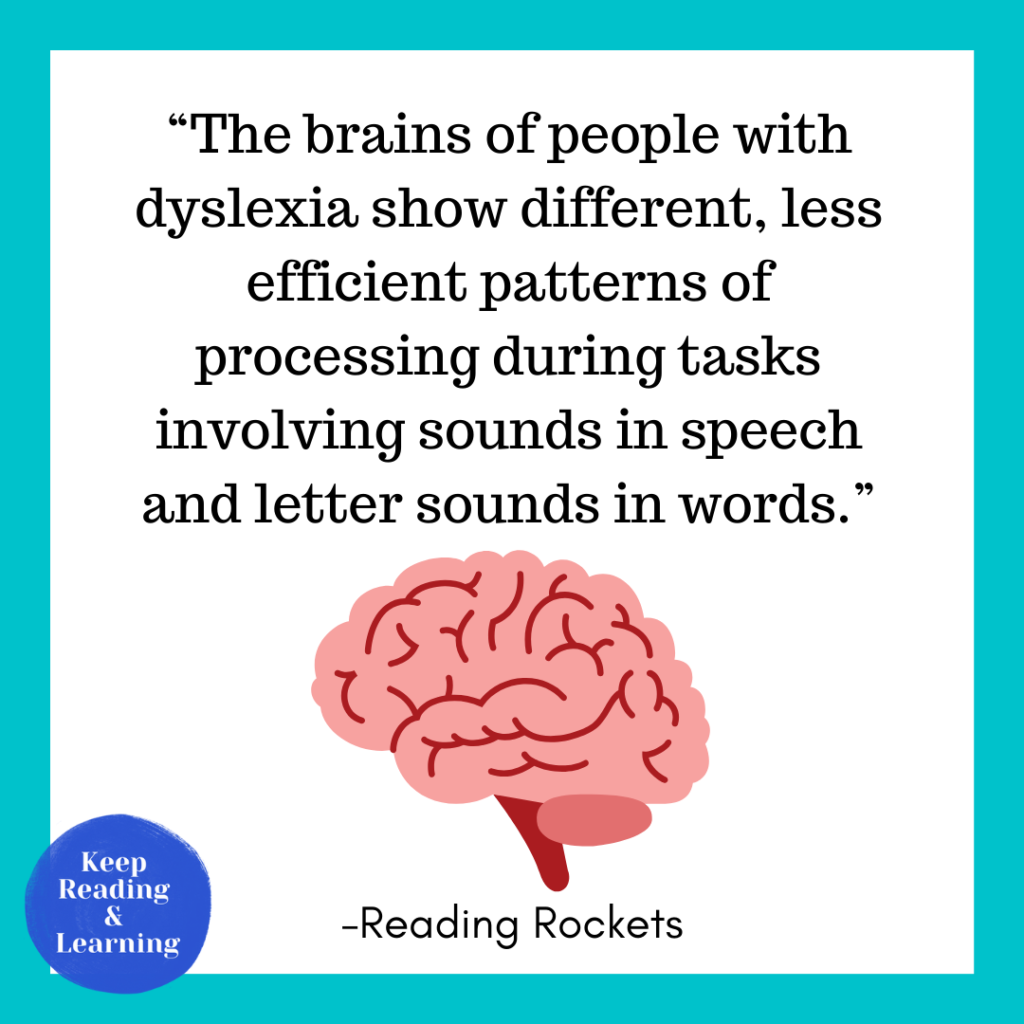 Dyslexia Brain Region Differences